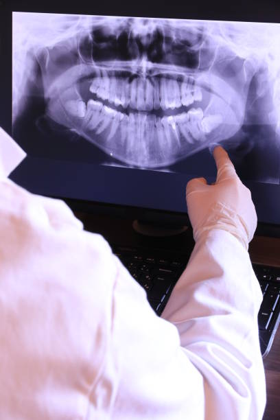 Best Emergency Gum Treatment in Plainfield Village, CT